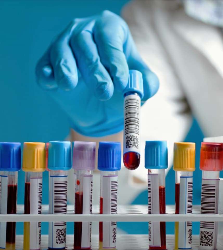 Service de prélèvement sanguin à domicile